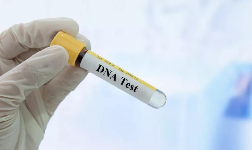 Y-DNA 验血检测